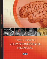 NEUROSSONOGRAFIA NEONATAL.pdf